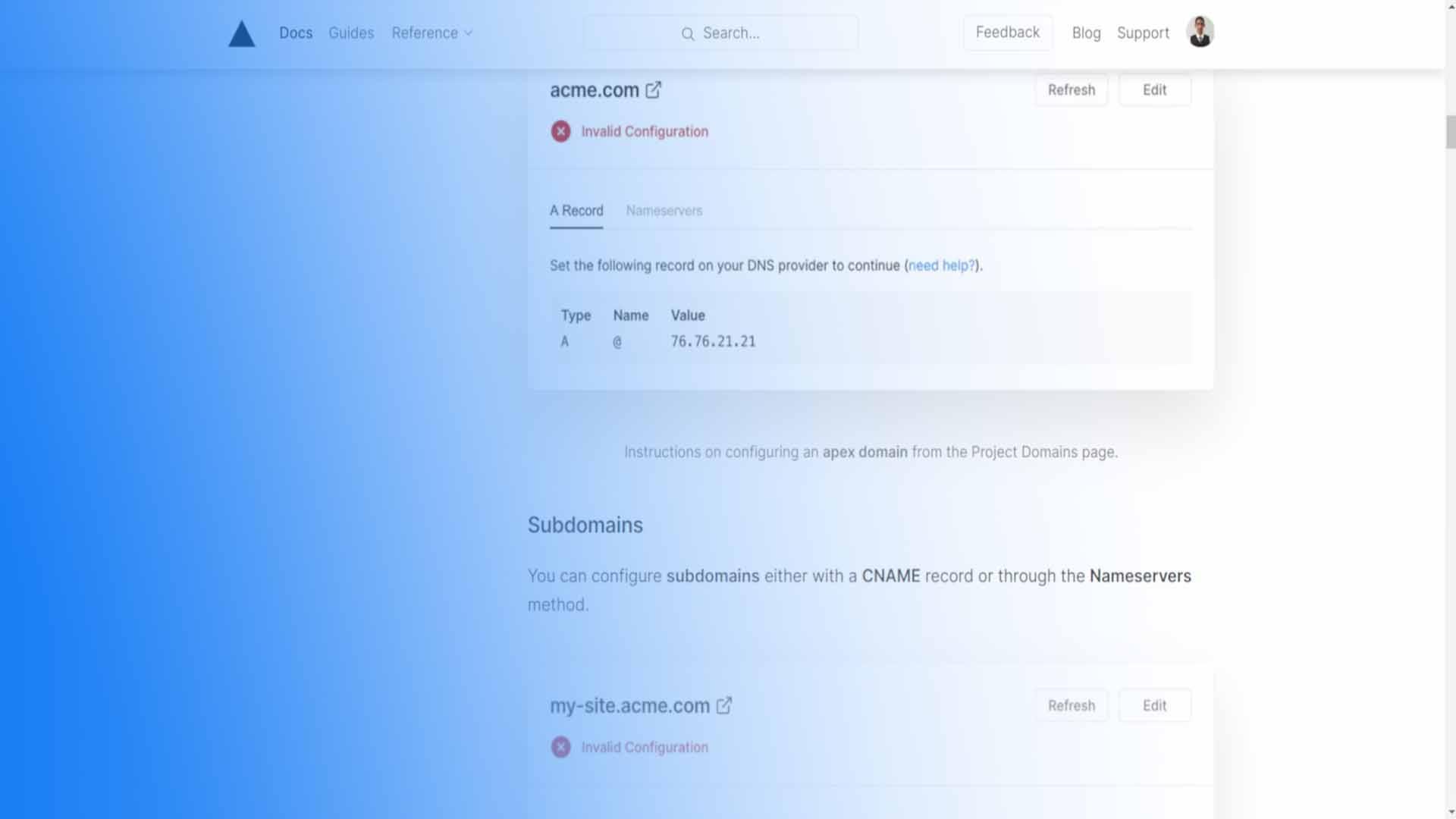 Vercel custom domain dashboard